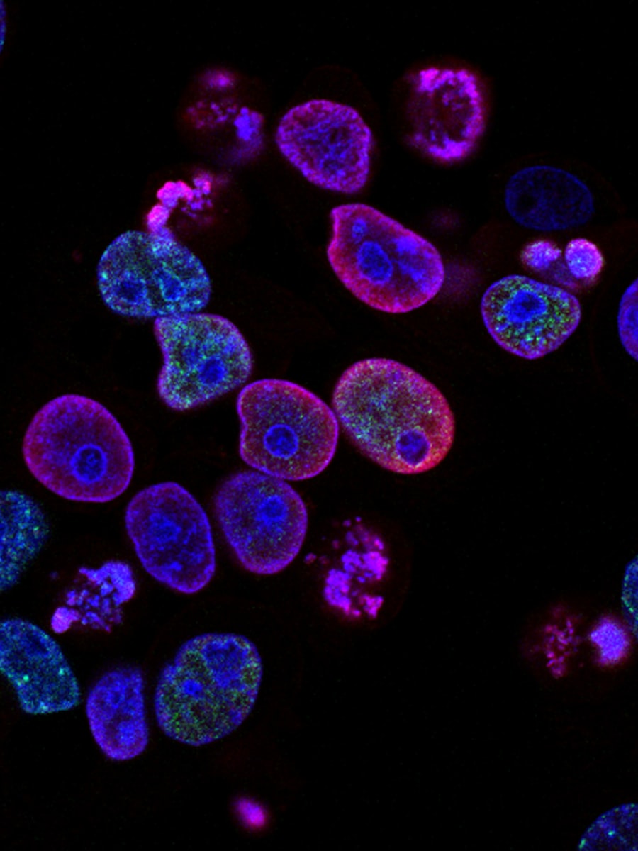 Fluorescence microscopy of stained cells in a laboratory study